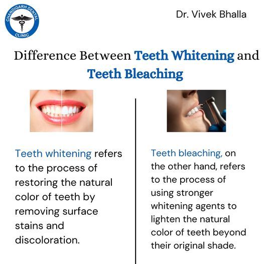 Top-Notch Dental Care at Chandigarh Dental Clinic - Book Your Appointment Today
