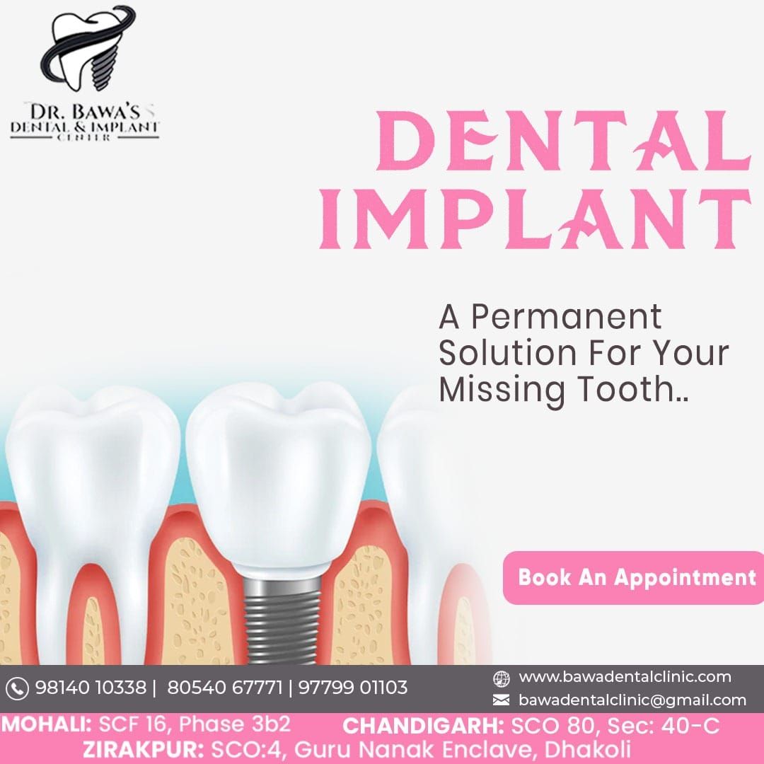 Transform Your Smile Today – Book Your Appointment at Bawa Dental & Implant Centre!