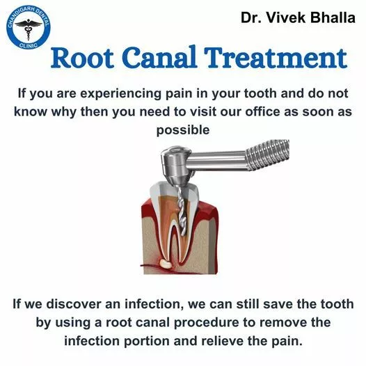 Top-Notch Dental Care at Chandigarh Dental Clinic - Book Your Appointment Today