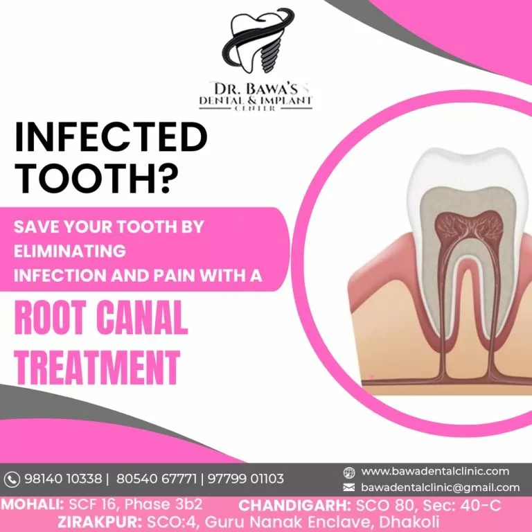 Transform Your Smile Today – Book Your Appointment at Bawa Dental & Implant Centre!