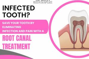 Transform Your Smile Today – Book Your Appointment at Bawa Dental & Implant Centre! - Doctors in India