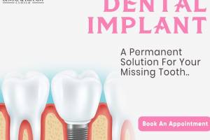 Transform Your Smile Today – Book Your Appointment at Bawa Dental & Implant Centre! - Doctors in India